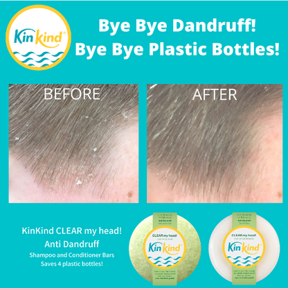KinKind CLEAR my head! shampoo and conditioner bars with before and after images of dandruff reduction on hair, on a blue background and text reading "Bye bye dandruff! Bye bye plastic bottles!"