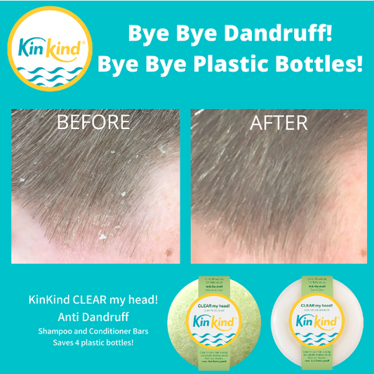 KinKind CLEAR my head! shampoo and conditioner bars with before and after images of dandruff reduction on hair, on a blue background and text reading "Bye bye dandruff! Bye bye plastic bottles!"